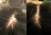 CAPD™
Scalp & Intense Repair Bundle