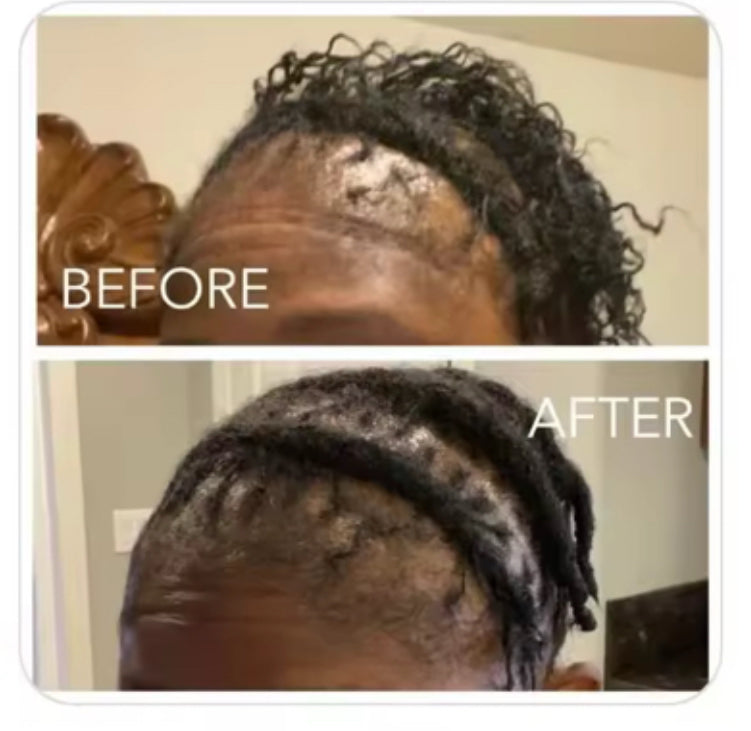 CAPD™ 
Scalp & Intense Repair Bundle